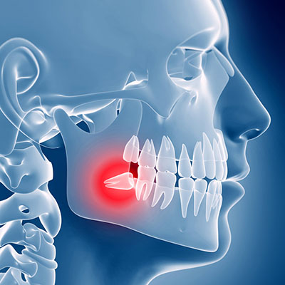 Chirurgia Orale Od Odontostomatologia